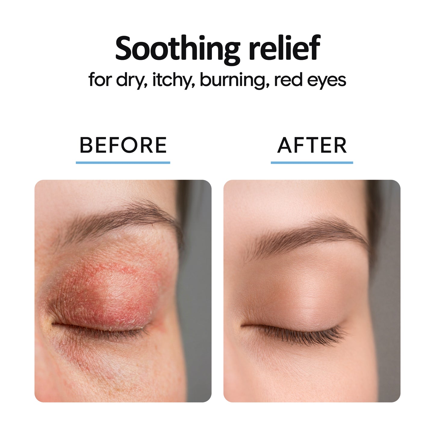 Eyelid Cleanser Spray 8oz