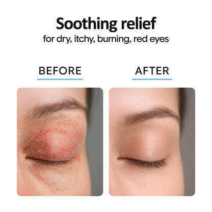 Eyelid Cleanser Spray 8oz